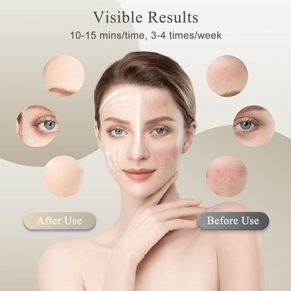 Solasup™ Total-Renewal Face & Neck LED Mask (309 LEDs)